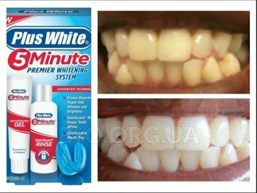 plus white teeth gel